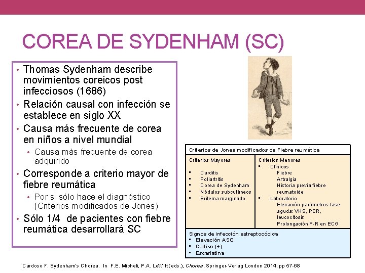 COREA DE SYDENHAM (SC) • Thomas Sydenham describe movimientos coreicos post infecciosos (1686) •