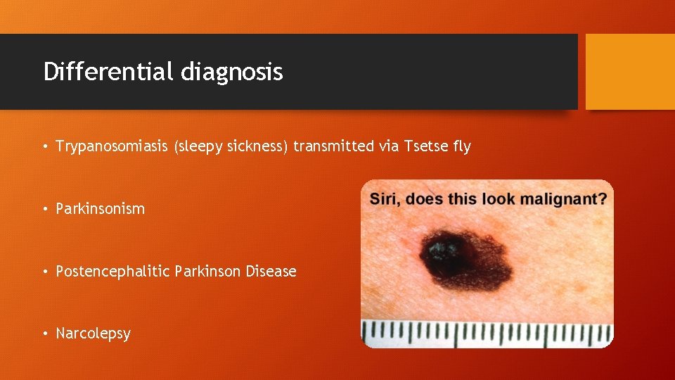 Differential diagnosis • Trypanosomiasis (sleepy sickness) transmitted via Tsetse fly • Parkinsonism • Postencephalitic