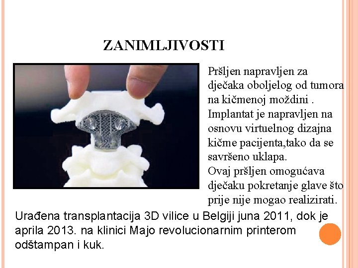 ZANIMLJIVOSTI Pršljen napravljen za dječaka oboljelog od tumora na kičmenoj moždini. Implantat je napravljen