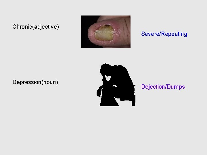 Chronic(adjective) Severe/Repeating Depression(noun) Dejection/Dumps 