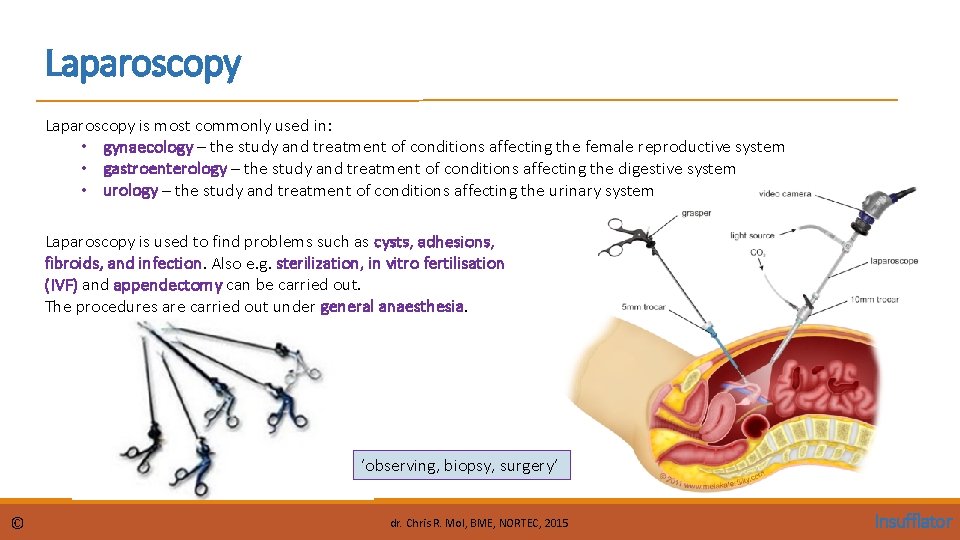 Laparoscopy is most commonly used in: • gynaecology – the study and treatment of