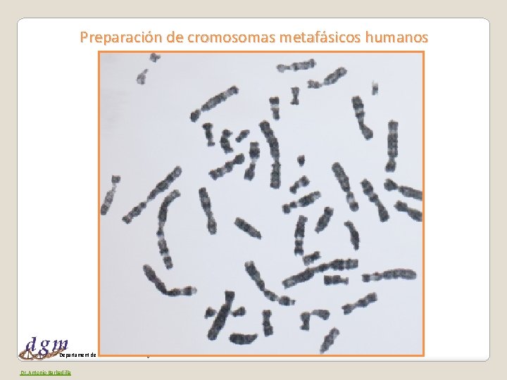 Preparación de cromosomas metafásicos humanos Departament de Genètica i Microbiologia Dr. Antonio Barbadilla 
