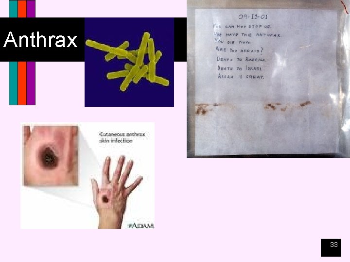 Anthrax 33 