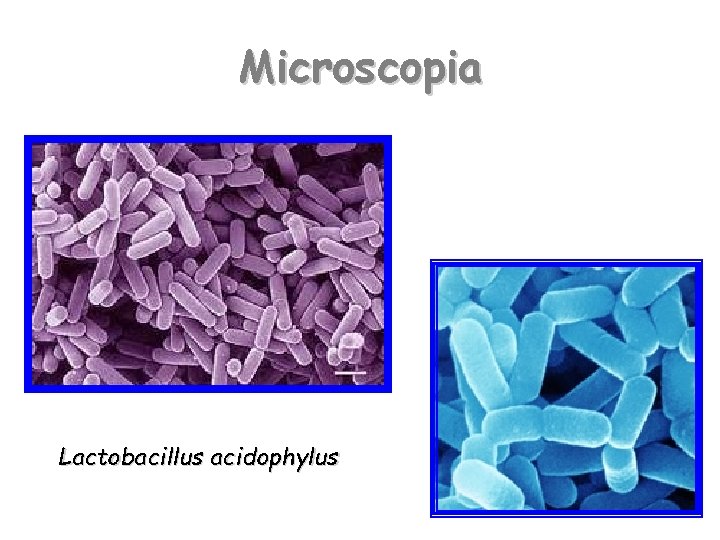 Microscopia Lactobacillus acidophylus 