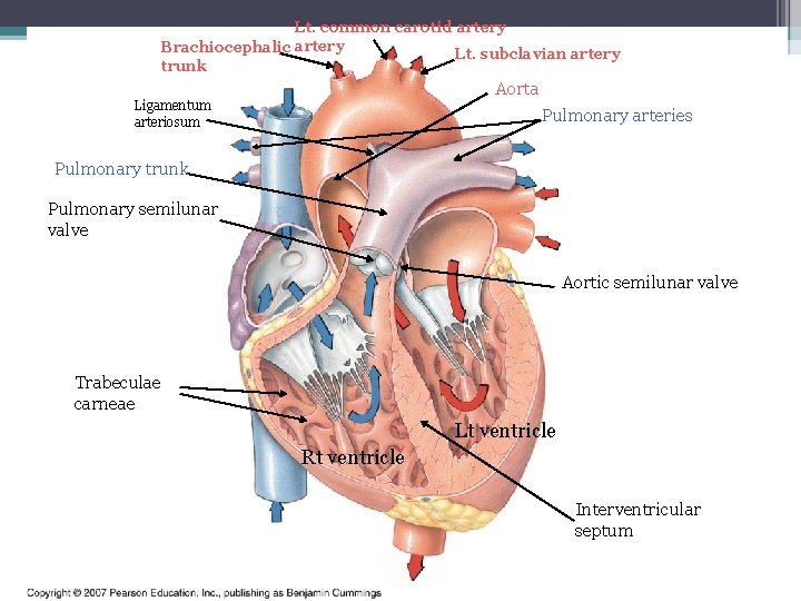 Lt. common carotid artery Brachiocephalic artery Lt. subclavian artery trunk Aorta Ligamentum arteriosum Pulmonary