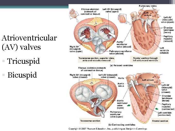 Atrioventricular (AV) valves § Tricuspid § Bicuspid 