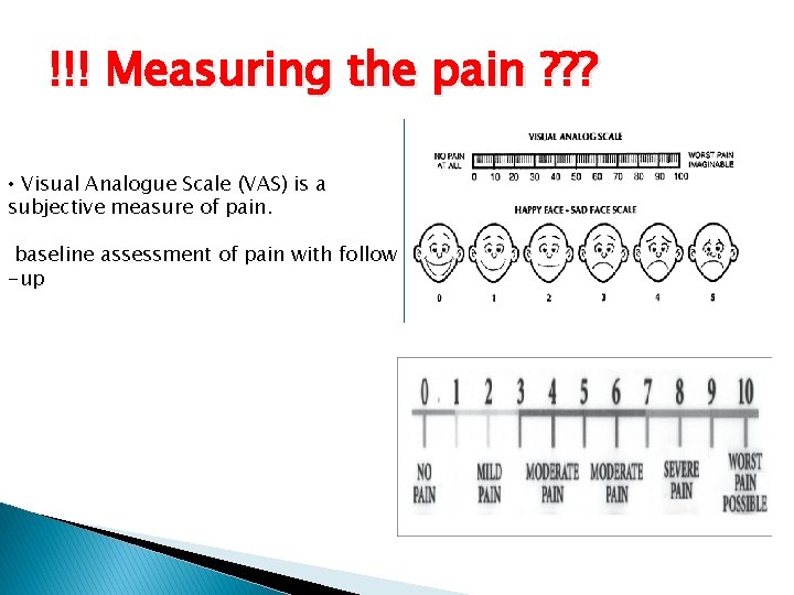 Vas Scale Example Physiology of Pain Dr Abdulrahman Alhowikan Collage of