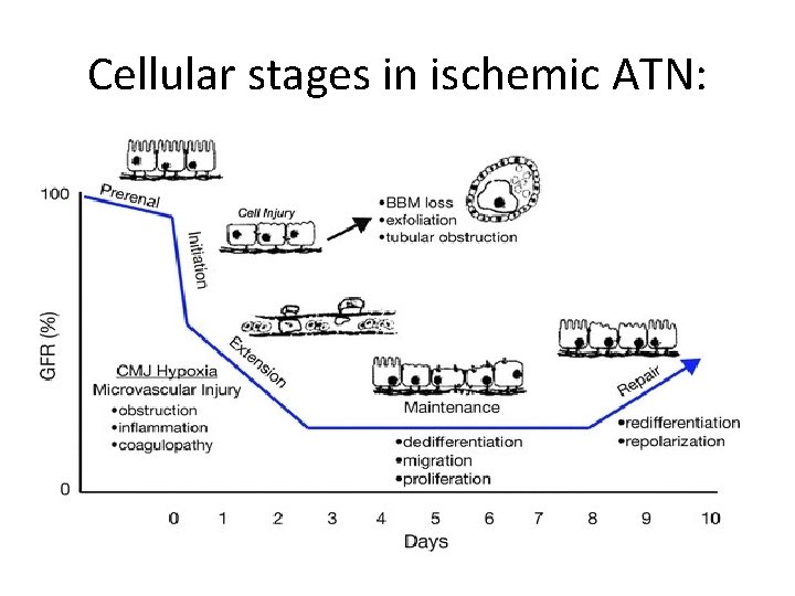 Cellular stages in ischemic ATN: 