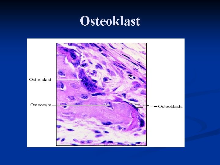 Osteoklast 