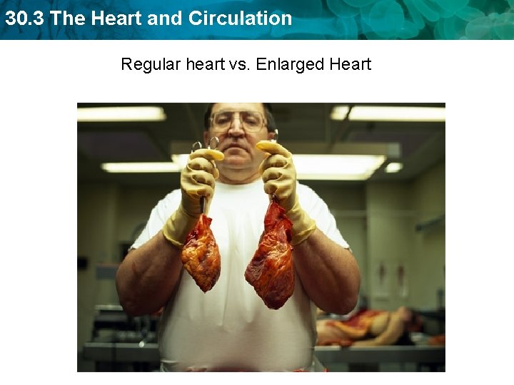 30. 3 The Heart and Circulation Regular heart vs. Enlarged Heart 30. 3 The Heart and Circulation Regular heart vs. Enlarged Heart