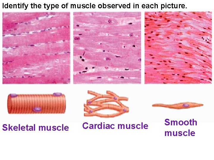 Identify the type of muscle observed in each picture. Skeletal muscle Cardiac muscle Smooth