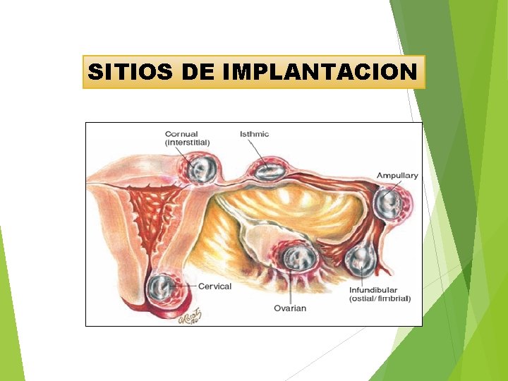 SITIOS DE IMPLANTACION 