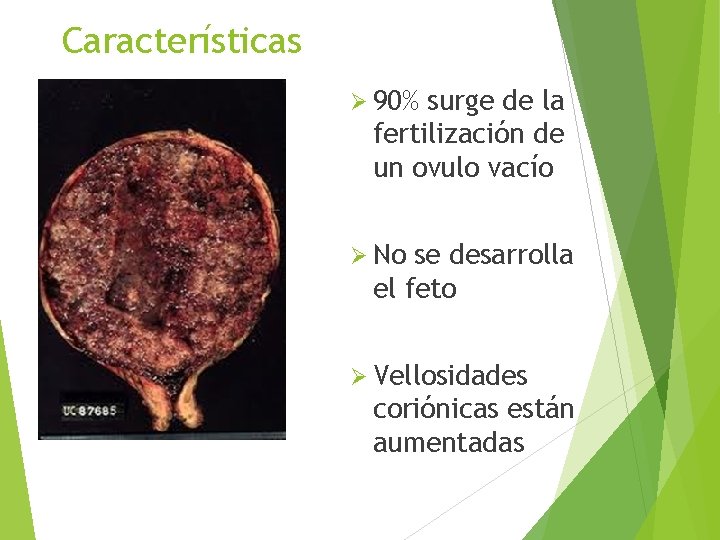 Características Ø 90% surge de la fertilización de un ovulo vacío Ø No se