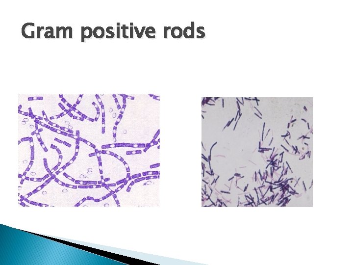 Gram positive rods 