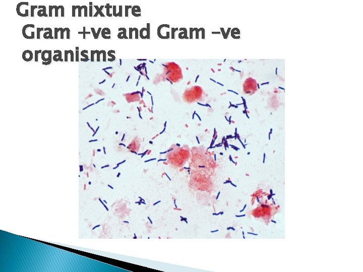 Gram mixture Gram +ve and Gram –ve organisms Gram mixture Gram +ve and Gram –ve organisms