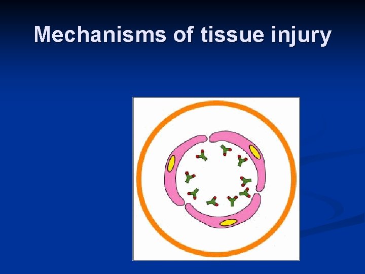 Mechanisms of tissue injury 