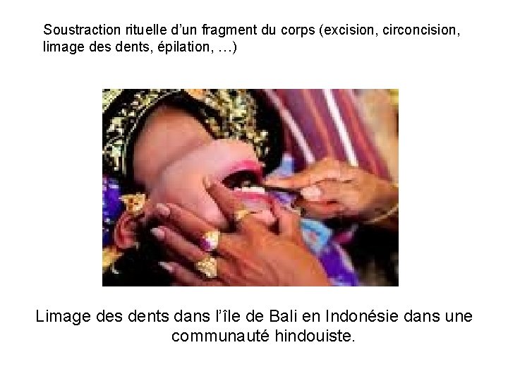 Soustraction rituelle d’un fragment du corps (excision, circoncision, limage des dents, épilation, …) Limage