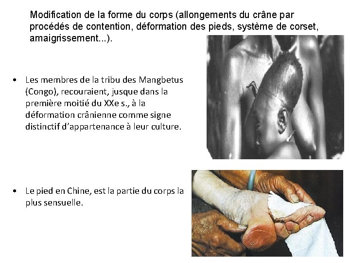 Modification de la forme du corps (allongements du crâne par procédés de contention, déformation