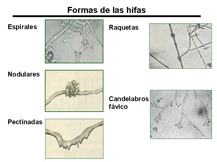 Formas de las hifas Espirales Raquetas Nodulares Candelabros fávico Pectinadas 