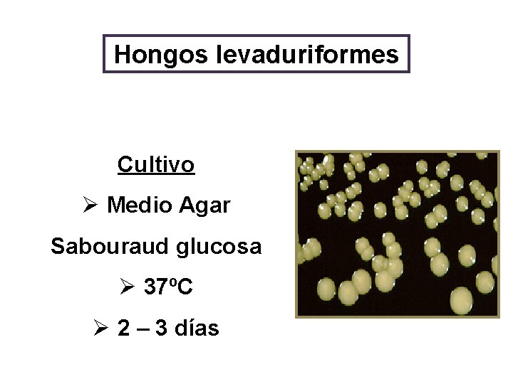 Hongos levaduriformes Cultivo Ø Medio Agar Sabouraud glucosa Ø 37ºC Ø 2 – 3