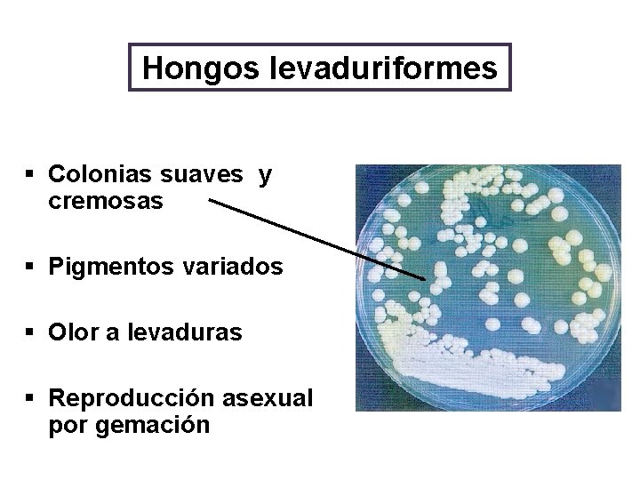 Hongos levaduriformes § Colonias suaves y cremosas § Pigmentos variados § Olor a levaduras