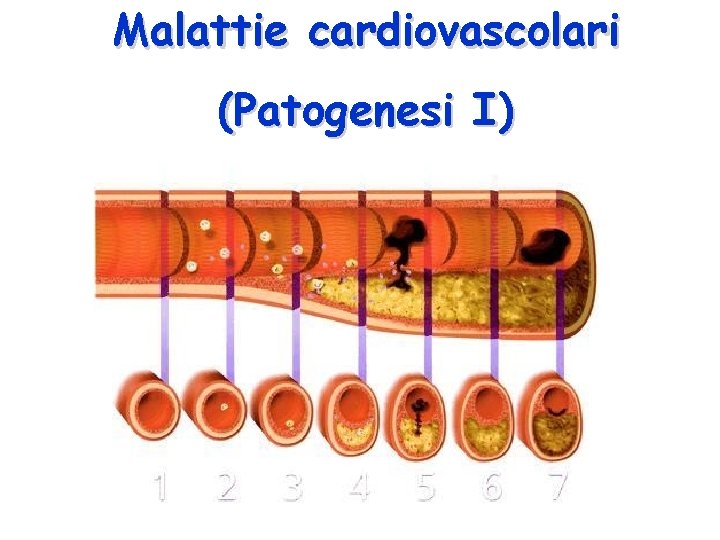 Malattie cardiovascolari (Patogenesi I) 
