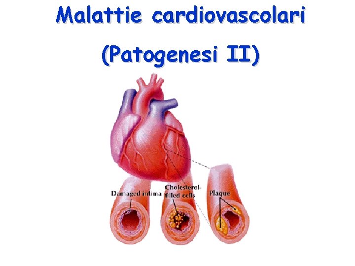 Malattie cardiovascolari (Patogenesi II) 