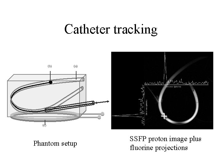Catheter tracking (b) (a) (c) Phantom setup SSFP proton image plus fluorine projections 