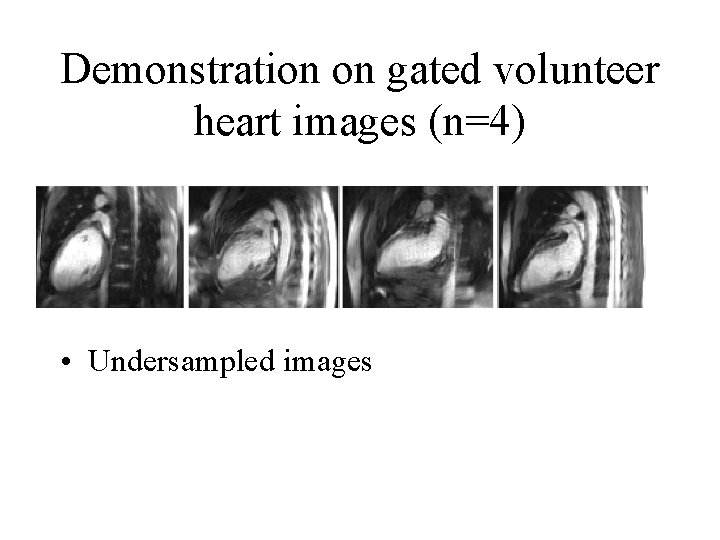 Demonstration on gated volunteer heart images (n=4) • Undersampled images 