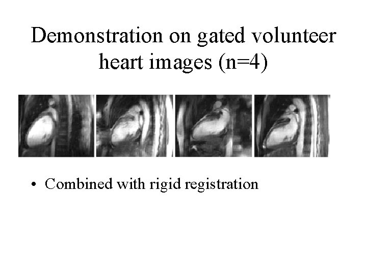 Demonstration on gated volunteer heart images (n=4) • Combined with rigid registration 