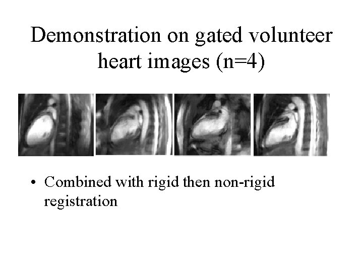 Demonstration on gated volunteer heart images (n=4) • Combined with rigid then non-rigid registration