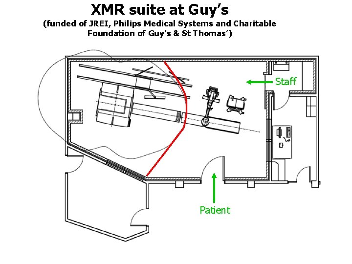 XMR suite at Guy’s (funded of JREI, Philips Medical Systems and Charitable Foundation of