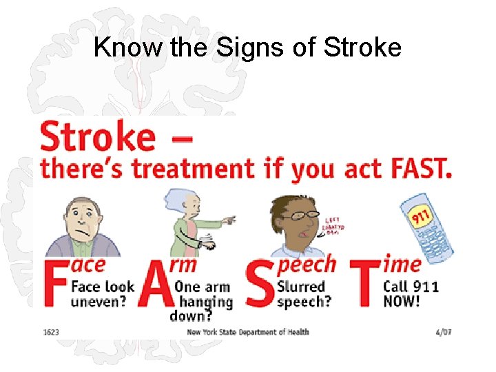 Know the Signs of Stroke 