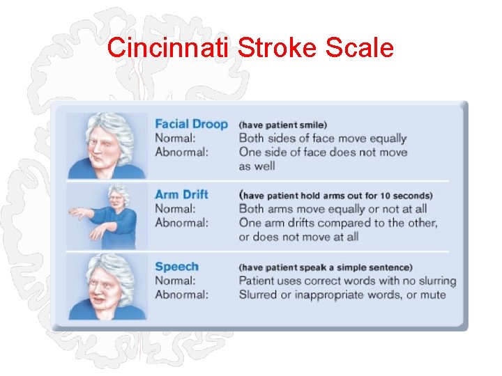 Cincinnati Stroke Scale 