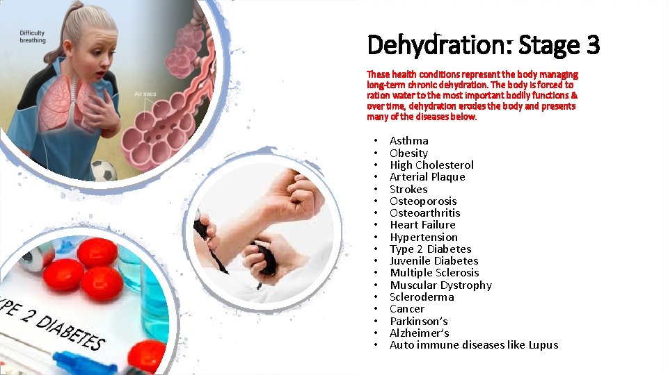 Dehydration: Stage 3 These health conditions represent the body managing long-term chronic dehydration. The Dehydration: Stage 3 These health conditions represent the body managing long-term chronic dehydration. The