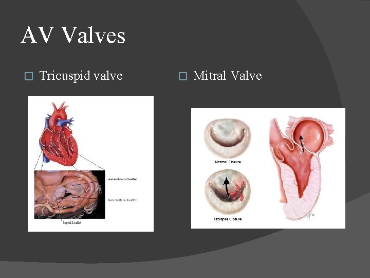 AV Valves � Tricuspid valve � Mitral Valve AV Valves � Tricuspid valve � Mitral Valve