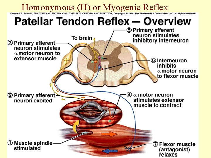 Homonymous (H) or Myogenic Reflex 