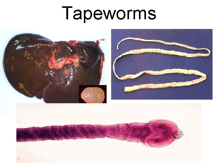 Tapeworms 