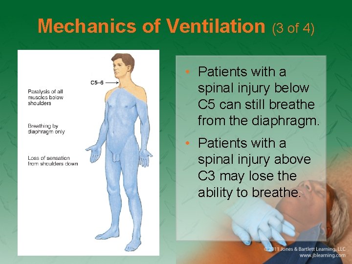 Mechanics of Ventilation (3 of 4) • Patients with a spinal injury below C