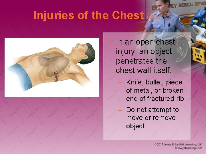 Injuries of the Chest (3 of 7) • In an open chest injury, an