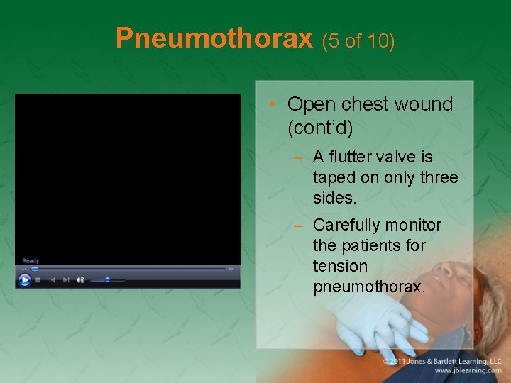 Pneumothorax (5 of 10) • Open chest wound (cont’d) – A flutter valve is