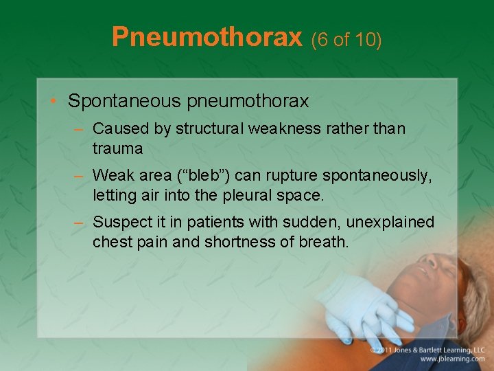 Pneumothorax (6 of 10) • Spontaneous pneumothorax – Caused by structural weakness rather than