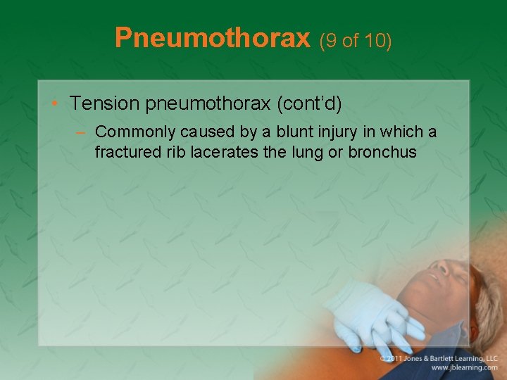 Pneumothorax (9 of 10) • Tension pneumothorax (cont’d) – Commonly caused by a blunt