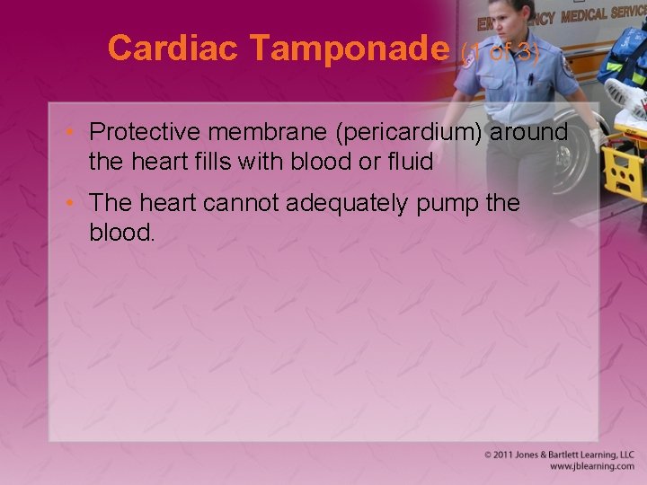 Cardiac Tamponade (1 of 3) • Protective membrane (pericardium) around the heart fills with