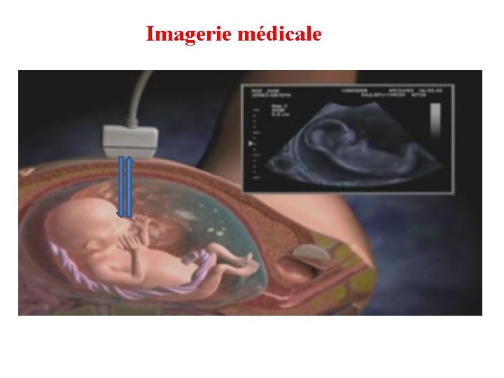 Imagerie médicale 