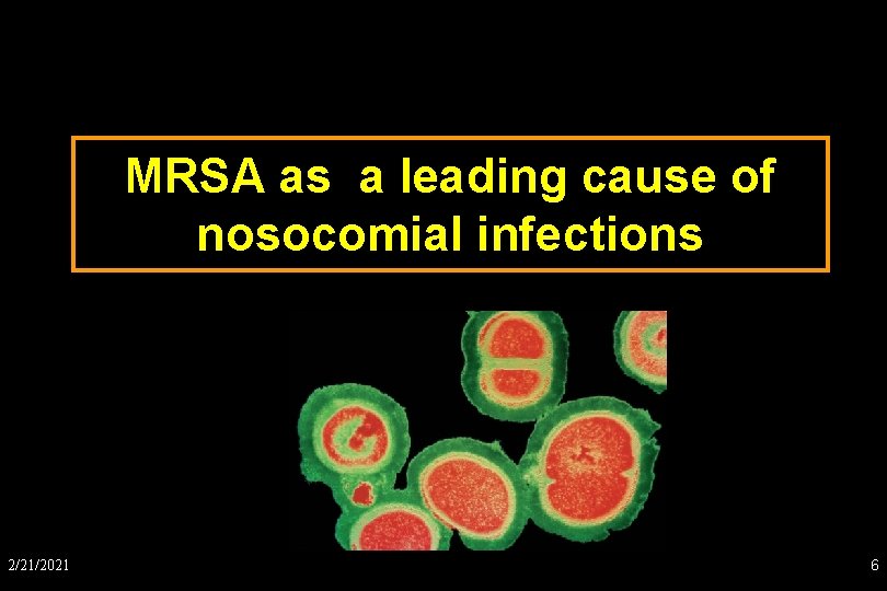 MRSA as a leading cause of nosocomial infections 2/21/2021 6 