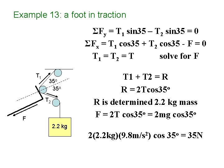 Example 13: a foot in traction ΣFy = T 1 sin 35 – T