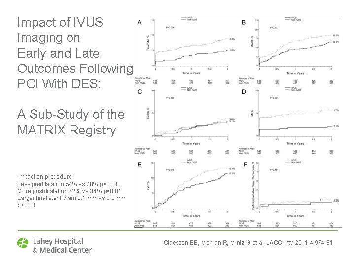 Impact of IVUS Imaging on Early and Late Outcomes Following PCI With DES: A