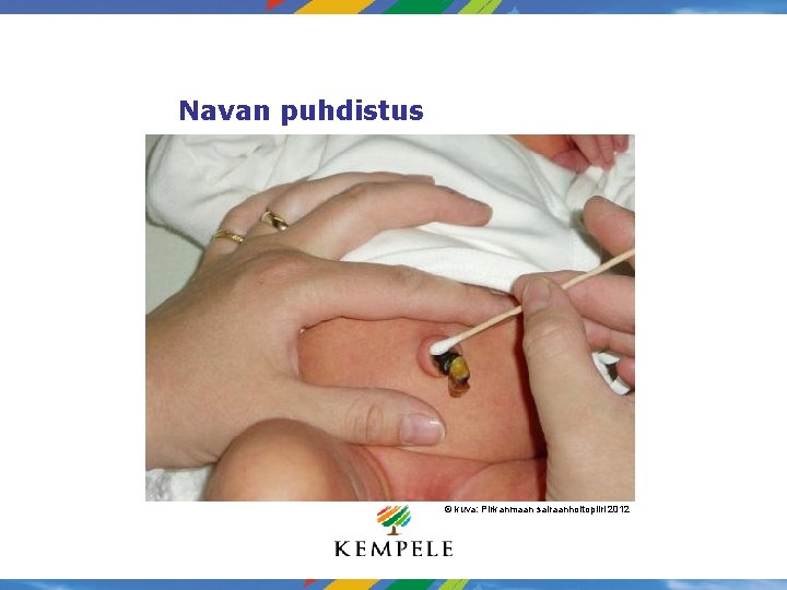 Navan puhdistus © kuva: Pirkanmaan sairaanhoitopiiri 2012 Navan puhdistus © kuva: Pirkanmaan sairaanhoitopiiri 2012