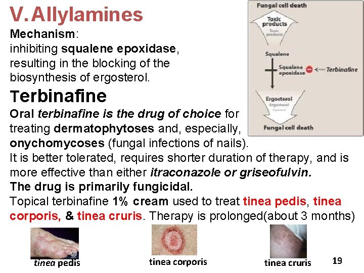 V. Allylamines Mechanism: inhibiting squalene epoxidase, resulting in the blocking of the biosynthesis of